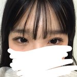 쌍수 한<b>달차</b>인데 봐주라