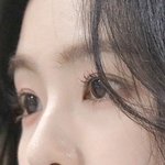 [댓글부탁해] 대학 다니던 중에 <b>성형</b>하면