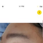 쌍수고민이야ㅠ 눈좀봐줘ㅠ