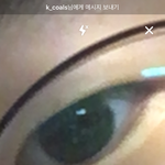쌍수가 시급한 <b>내</b> <b>눈</b>