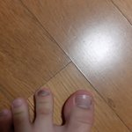 [댓글부탁해] <b>발톱</b> 색깔이 이상해