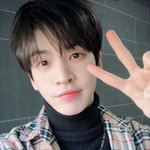 [프듀X] 스타쉽 <b>앨런</b> 콧볼축소나 코끝 연골묶기 해줘