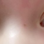 쌍수 4일<b>차야</b> 라인어때