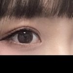 [댓글부탁해] 나 쌍수한지 딱 1년댔ㄴ는데 여기서 붓기 더 빠짐...