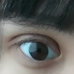 [댓글부탁해] 쌍수 붓기<b>주사</b> 맞으러간당ㅠㅜ