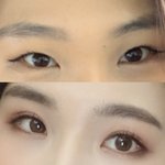 [댓글부탁해] <b>쌍수</b> 후기~