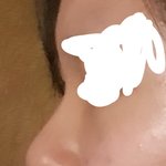 [댓글부탁해] 코 성형할까 말까... 좀 봐<b>주</b><b>셈</b>