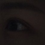 쌍수하고 싶은데 병원가서ㅜ뭐라말할까..<b>쌩눈</b>주의