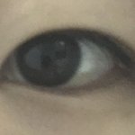 [꼭조언부탁] 쌍수 할말 <b>정해</b>죠 ㅠㅠㅠ