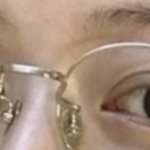 [댓글부탁해] 얘들아 <b>쌍수</b>잘된케이스