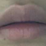 [조언부탁해] (약혐)나 입꼬리부분에 <b>색소</b>침착?쩌는데 어카냐
