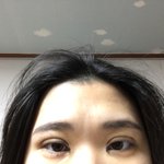 얘들아 나 쌍수 불안해