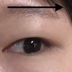 오늘 <b>쌍수</b>하는데 <b>쌍수</b> <b>전</b> 눈좀 봐줘