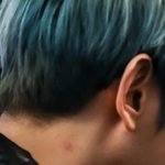 이거 키스<b>마크</b>야? 아니면 걍 벌레물린건가..