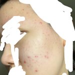 혐ㅈㅇ) 이런 여드름 피부에 좋은 <b>제품</b> 추천해줘ㅠㅠㅠ