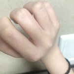 손가락살은 도대체 어떻게빼냐