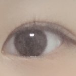 [꼭조언부탁] 쌍수하는게 나을까?