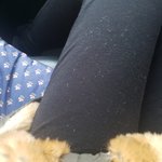 [꼭조언부탁] 내피모피는원래 <b>이리</b>빠지나요?