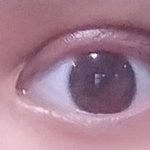 [댓글부탁해] 쌍수 <b>점막</b>들림 많이심함??