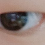 겨울방학때 쌍수할거 쌍수해도 괜찮을지 봐주라 해본애들아 조언도 좀...