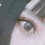 [댓글부탁해] 쌍수 망한거같음?