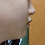 [댓글부탁해] 이거 <b>무턱</b> 이야???