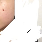 [댓글부탁해] 약혐) 얘들아 쌍수 <b>얼음</b>팩 하면 원래 이래..?