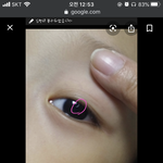 [드루와] 눈에 <b>상처</b>났는데 들어와봐ㅜㅜ