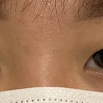 쌍수<b>전후</b>좀 봐주세요