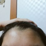 <b>셀프</b> 헤어라인 정리 해봤는데 어때