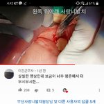 [댓글부탁해] <b>And</b>