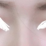 나 콧볼 <b>축소</b>하면 될까??