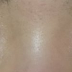 [꼭조언부탁] 쌍액했는데 <b>쌩눈</b>이 나아...?