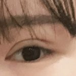 내 쌍수<b>전후</b> 어떰