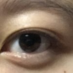<b>내</b> <b>눈</b> 앞뒷트임 필요해보여??