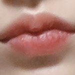 나 입술<b>필러</b> 티 많이나?