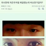 [드루와] <b>남자</b>도 <b>쌍수</b>를 해야된다