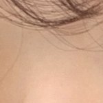 [꼭조언부탁] (눈사진있음)무<b>쌍</b>?<b>속쌍</b>의 중간인데 앞트임 어떻게 생각해