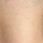 [댓글부탁해] 나 쌍수 이거 <b>눈지방</b> 많아서 망한거지?