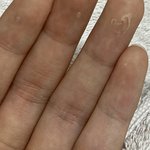 피부 껍질 <b>이케</b> 되는 거 왜이런지 아는 사람 ㅠㅠㅠ