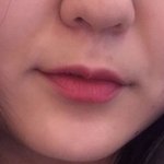 [드루와] <b>팔자</b>주름때문에 죽고싶어ㅠㅠㅠ