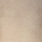 [조언부탁해] 나 쌍수 <b>재수술</b>해야겟지않어?