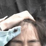[댓글부탁해] 뷔 <b>탈모</b> 심하네.JPG
