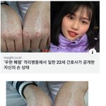 '코로나19'격리<b>병동</b> 22세 간호사의 손상태