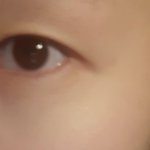 [드루와] 쌍수 할말 조언좀<b>해조</b>ㅠㅠㅠ
