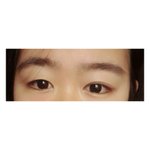 쌍수 하는게 나을까?