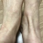 [댓글부탁해] 사진혐) 수족냉증 있는 애들 들어와봐