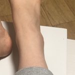 [댓글부탁해] 내 <b>발목</b>좀 봐줘 ㅈㅂ ㅠㅠㅠ
