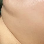 [댓글부탁해] 턱살 나보다 많은 <b>살암</b>?..ㅎㅎ