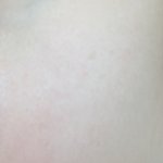 나 피부 개좋다 미쳤냐